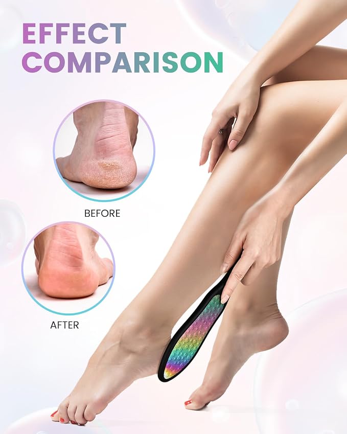 BEZOX Foot File Callus Remover, Double Sided Callus File Scraper, Foot Scrubber - Image 3