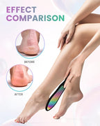 BEZOX Foot File Callus Remover, Double Sided Callus File Scraper, Foot Scrubber - Image 3