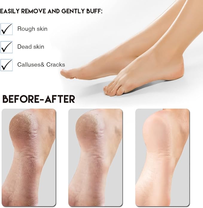 AM 8:00Pumice Stone Foot File, 2 Pack Callus Remover - Image 5