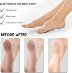 AM 8:00Pumice Stone Foot File, 2 Pack Callus Remover - Image 5