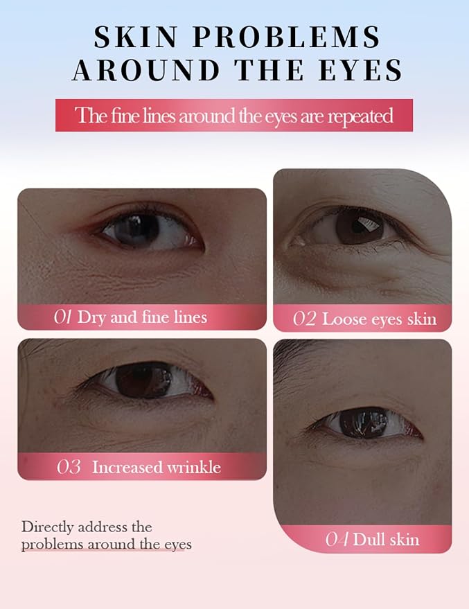Under Eye Patches for Dark Circles - Image 3