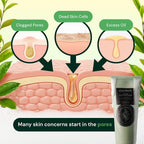 Tea Tree relief Foam Cleanser – Gentle Daily Face Wash - Image 6
