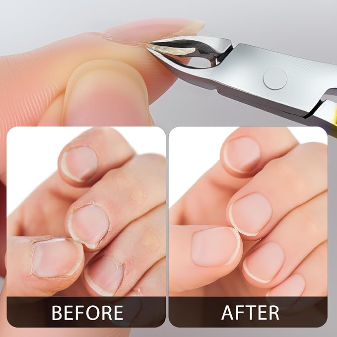 Cuticle Nippers Kit: Precision Nano-Coated Stainless Steel Cuticle Trimmer - Image 3