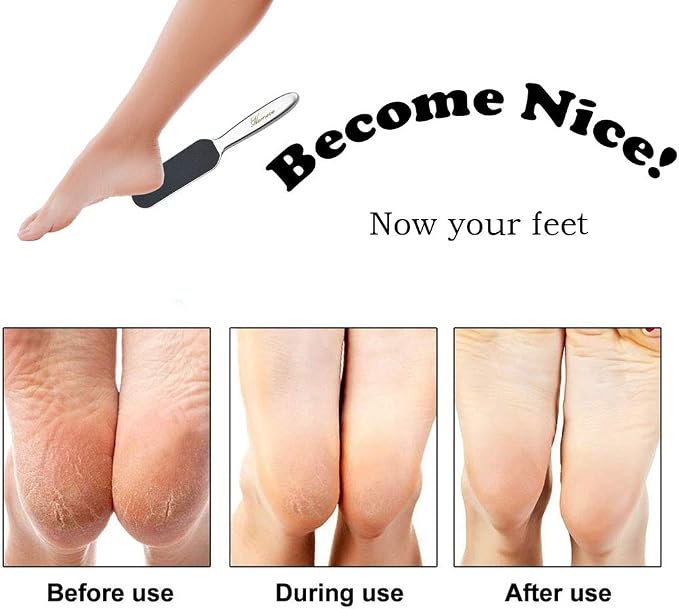 Professional Pedicure Foot File - Image 7