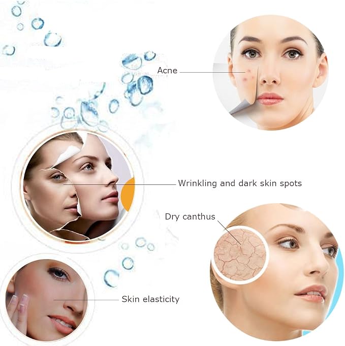 Hann Facial Steamer Professional Sinus Steam Inhaler Face Skin Moisturizer - Image 3