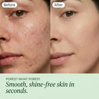 QUIA Toner Pads – AHA/BHA Dual-Action Exfoliate and Hydrate All in One – - Image 2