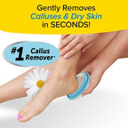 PedEgg Foot File – Traps Shavings Inside - Image 2