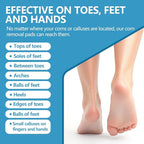 Corn removers for Toes feet Bottom of Foot Corn Remover, Corn Pads Callus - Image 5