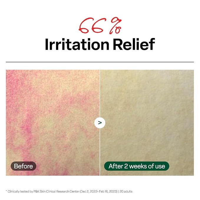 Dr. G R.E.D. Blemish Clear Soothing Toner - Image 5