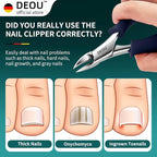 DEOU Podiatrist Toenail Clippers Ingrown Toenail Tools - Image 2