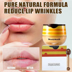 2PCS Bee Lip Balm Honey Pot - Image 7