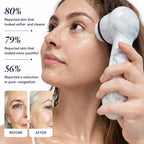Michael Todd Beauty Soniclear Allure 2024 Best of Beauty Winner Facial - Image 5