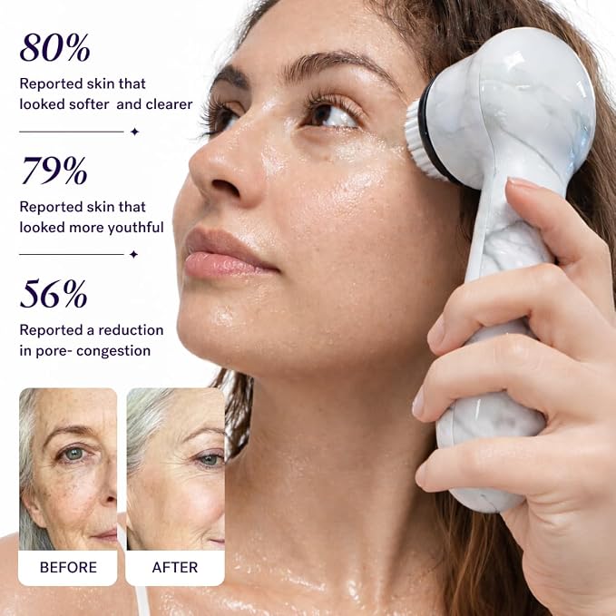 Michael Todd Beauty Soniclear Allure 2024 Best of Beauty Winner Facial - Image 5