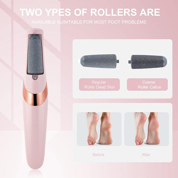 AOOWU Electric Foot File, USB Rechargeable Feet Callus Remover - Image 2