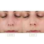 Clarisonic Sonic Face Exfoliator Cleansing Brush Head | Gentle Exfoliating - Image 4