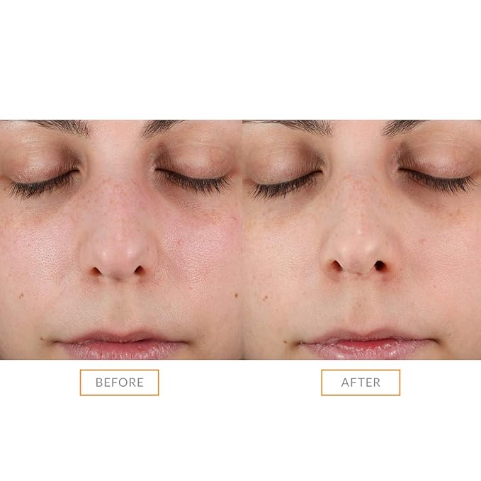Clarisonic Sonic Face Exfoliator Cleansing Brush Head | Gentle Exfoliating - Image 4