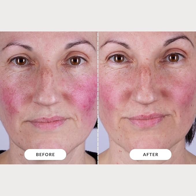 CurrentBody Skin LED Light Therapy Mask: Series 2 - Image 7