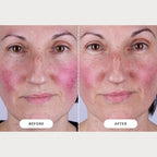 CurrentBody Skin LED Light Therapy Mask: Series 2 - Image 7