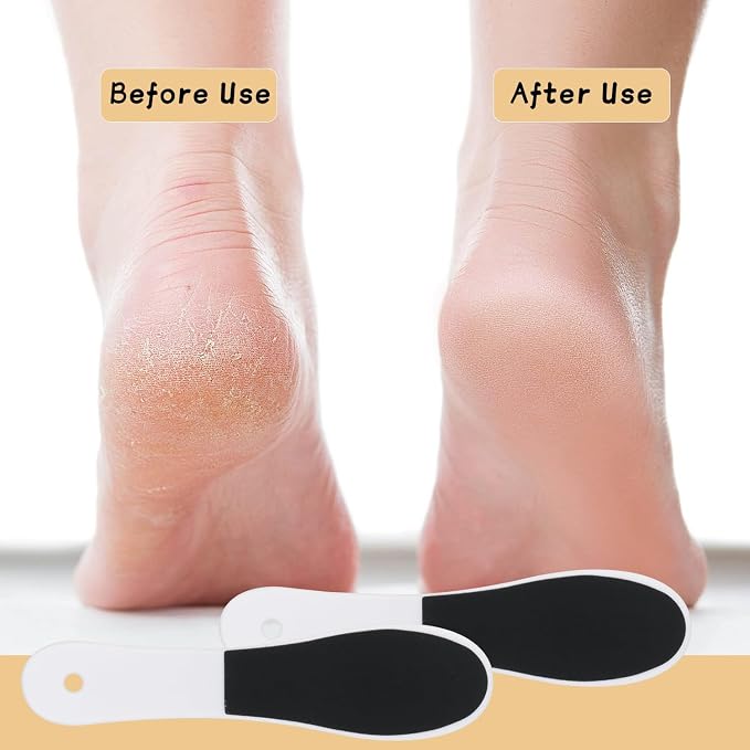 20 Pcs Foot File Callus Remover Double Side Skin Foot File Professional Foot - Image 5