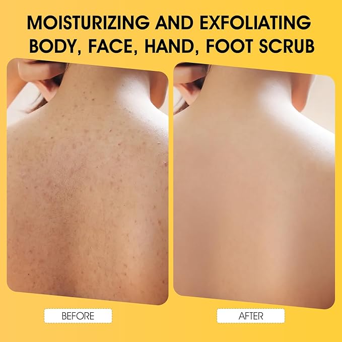 VOERUY Turmeric Body Scrub, 10% AHA/BHA & Vitamin C Exfoliating Body Scrub - Image 5
