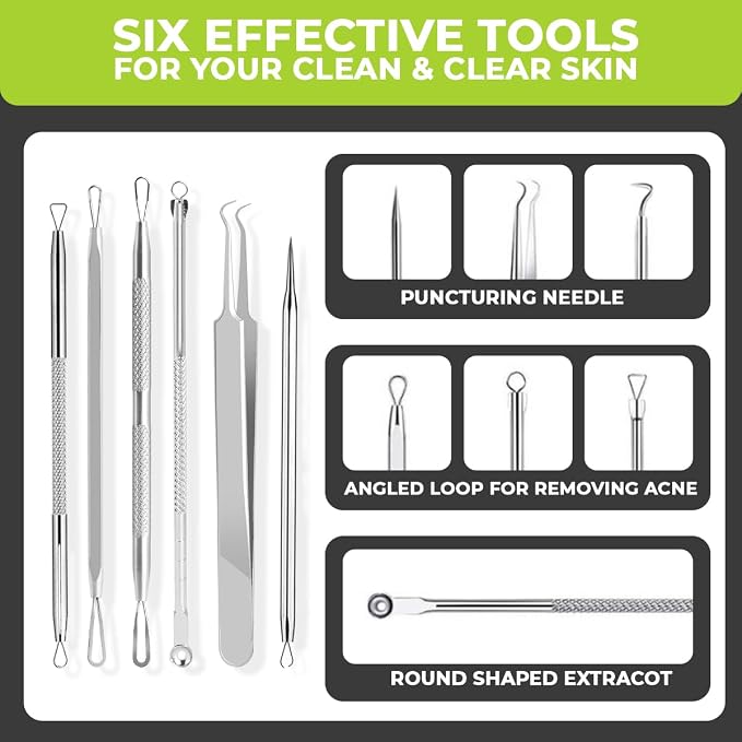 6 Pcs Blackhead Remover Tools 410 Grade Stainless Steel | Pimple Popper Tool - Image 4