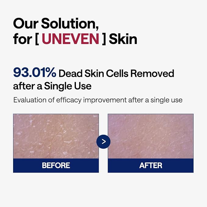 MEDIHEAL Toner Pads - Image 4