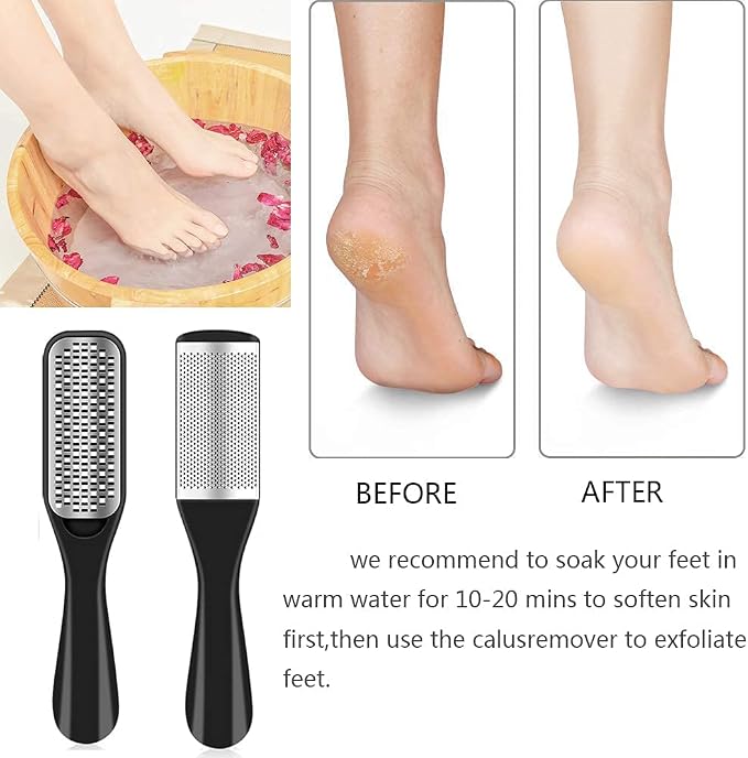 EKOCSIO Professional Pedicure Kit, 36 in 1 Stainless Steel Foot Care Kit Foot - Image 4