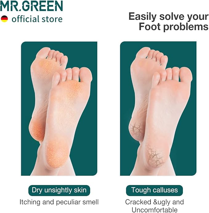 MR.GREEN Foot File Double Sided Pedicure Foot Care Tools Professional Callus - Image 3
