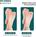 MR.GREEN Foot File Double Sided Pedicure Foot Care Tools Professional Callus - Image 3