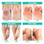 Lavinso Foot Peel Mask for Dry Cracked Feet – 2 Pack Peeling Mask Removes Dead - Image 3