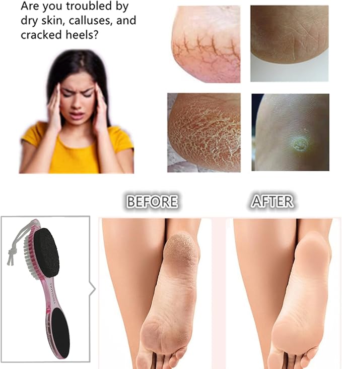 Foot File Callus Remover 4-in-1, Scrubber Brush, Foot Rasp and Sand Paper - Image 3