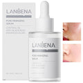 LANBENA Pore Minimizer for face, Skin Care, Pore Minimizer Treatment Serum 2.0 by LANBENA