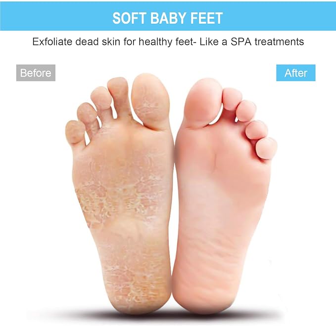 BESKAR XL Large Foot Scrubber Mat - Image 4