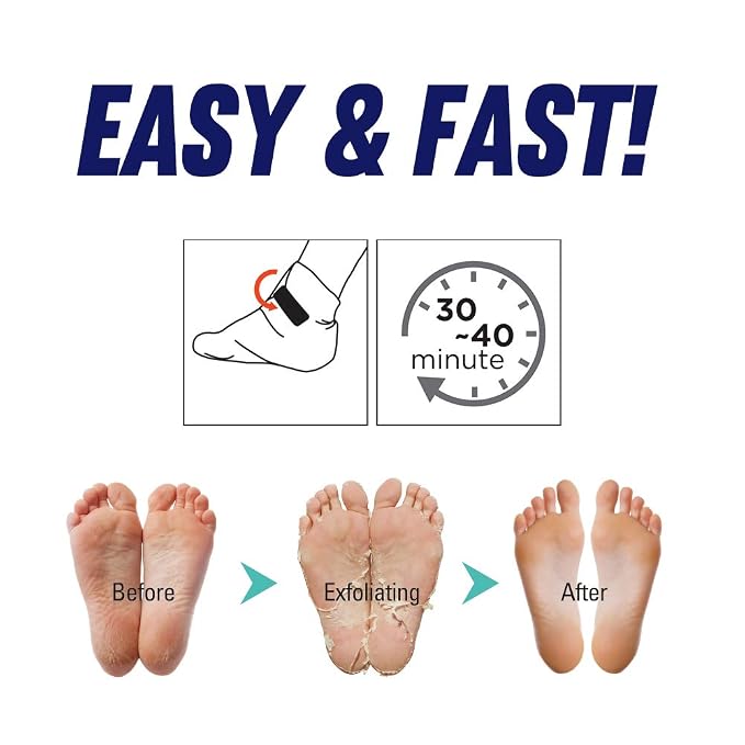 Epielle Foot Peel Mask | 2 Pairs | - Image 7