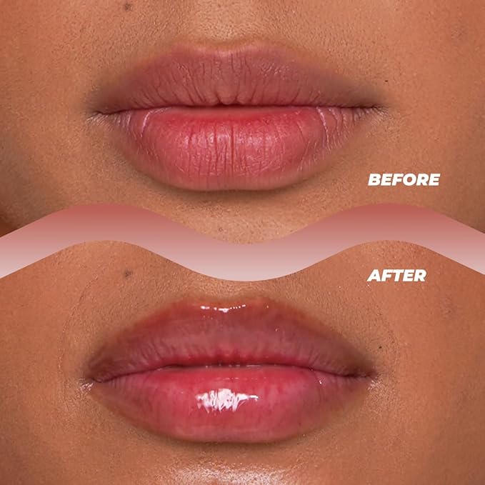 Vitamasques Lip Mask - Image 2