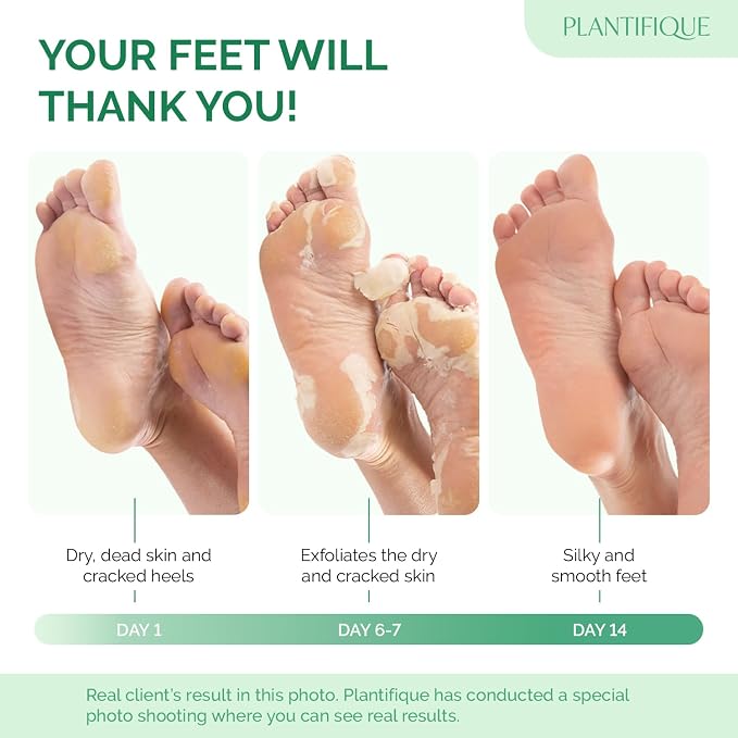 PLANTIFIQUE Foot Peeling Mask - Image 3