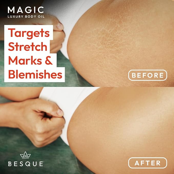 Besque Magic Body Oil, 3.4 FL OZ, After Shower Body Oil - Image 6