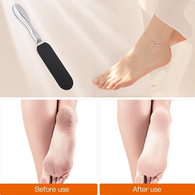Biutee Foot File for Dead Skin Pedicure Foot Files Callus Remover Professional - Image 5