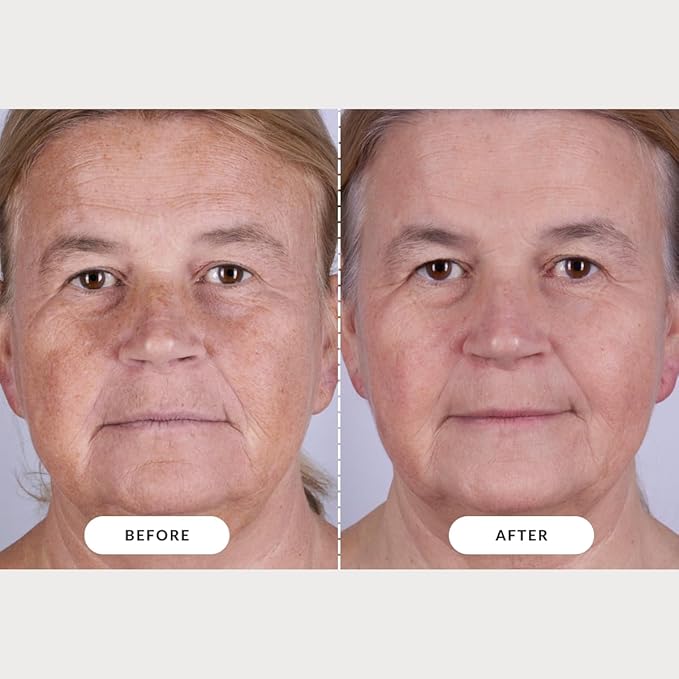CurrentBody Skin LED Light Therapy Mask: Series 2 - Image 5