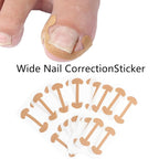 Professional Ingrown Toenail Correction Kit - Image 9