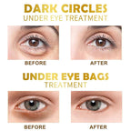 Under Eye Patches, 30 Pairs Gold Eye Mask, Eye Gel Pads - Image 4