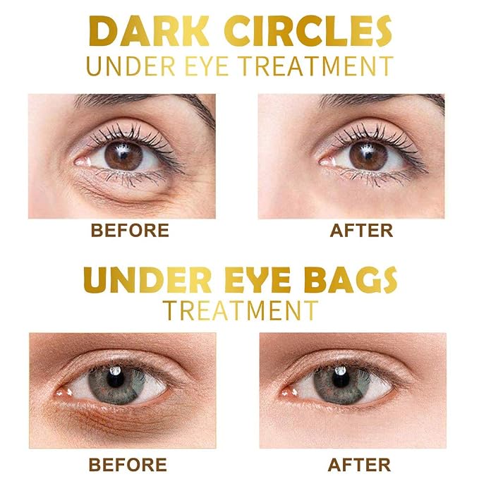 Under Eye Patches, 30 Pairs Gold Eye Mask, Eye Gel Pads - Image 4