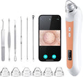 Facial Pore Blackhead Remover Vacuum, 1080P Camera Blackhead Remover, 20x Zoom by Ottleba