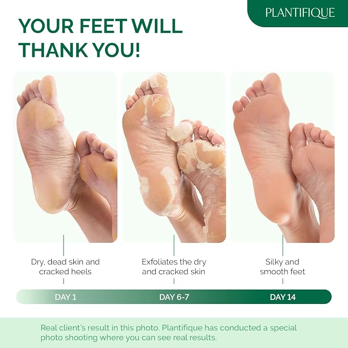 PLANTIFIQUE Foot Peeling Mask 2 Pack - Image 2