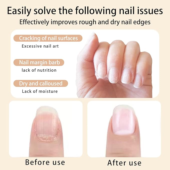 Cuticle Oil Pen Sweet Almond Nail Growth Serum and Repair Treatment Hydrating - Image 3