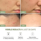 PLANTIFIQUE Korean Skincare Clay Mask – Hydrating Mud Mask - Image 2