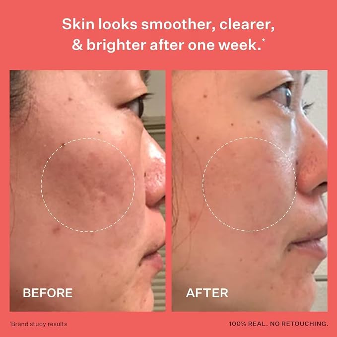 Peach & Lily - Glass Skin Refining Serum - Image 4
