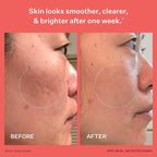 Peach & Lily - Glass Skin Refining Serum - Image 4
