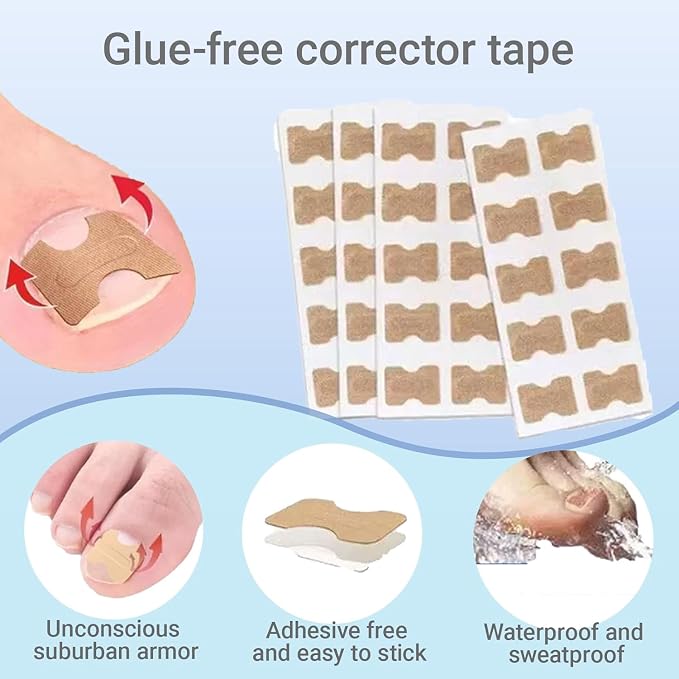 Ingrown Toenail Corrector Set - Image 3