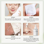 LANBENA 2-Pack Pore Strips: 2% Salicylic Acid BHA Nose Strips + Bamboo Charcoal - Image 9